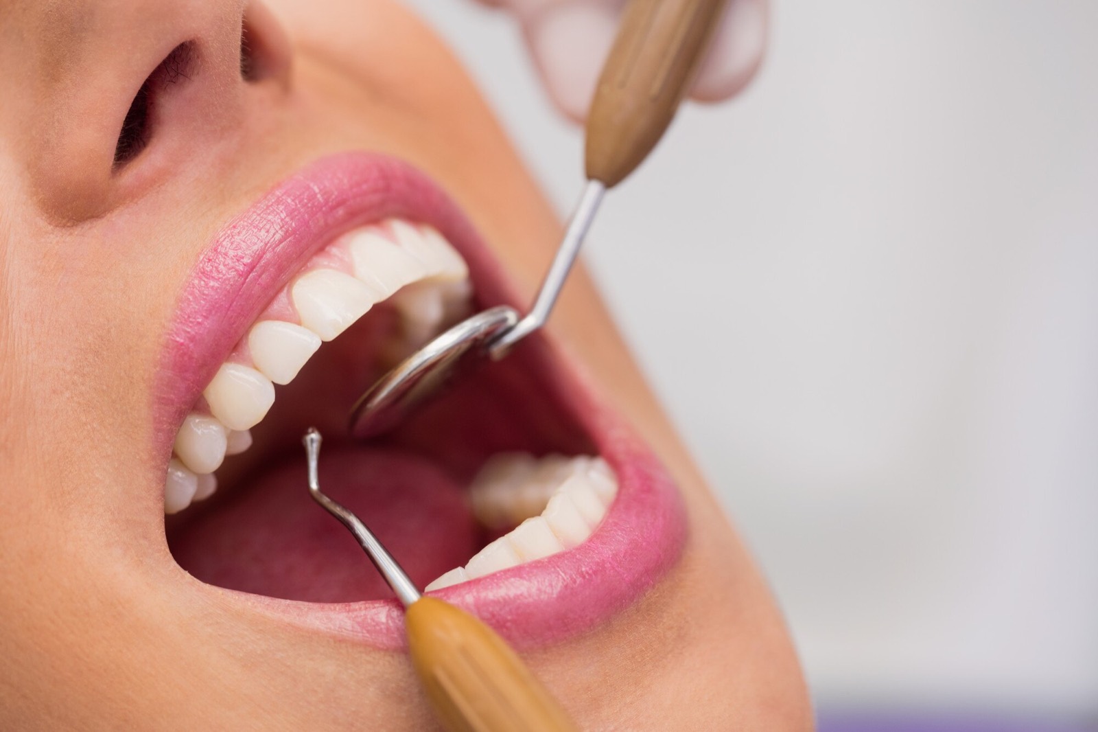 Close-up of teeth and gums being cleaned during a hygiene visit