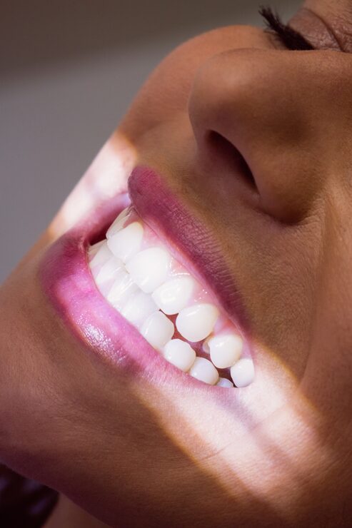 A bright smile after professional teeth whitening